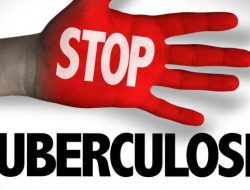 Setahun Ada 3.858 Kasus TBC di Kabupaten Tegal, 669 Anak Ikut Tertular