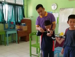 Gigi Kuning Bukan Berarti tidak Sehat, Yuk Simak Ini Penjelasan