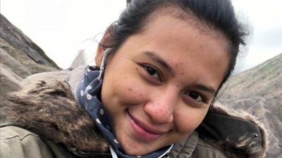 7 Cara Menghilangkan Bekas Jerawat secara Alami dalam Waktu 3 Hari, Mudah!