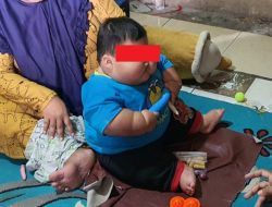 Bayi Obesitas di Bekasi 16 Bulan Beratnya 27 Kg, Menkes: Harus Dirawat