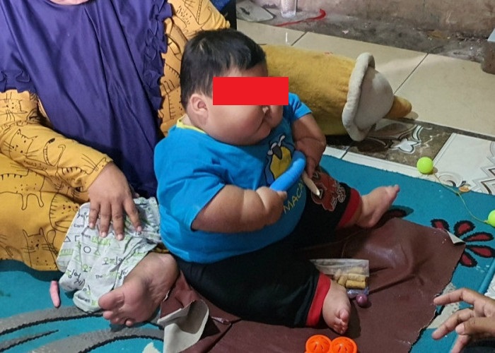 Bayi obesitas di Kabupaten Bekasi.
